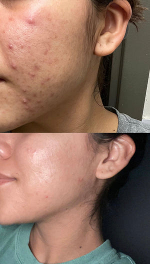 Charcoal Lemongrass Cleansing Bar