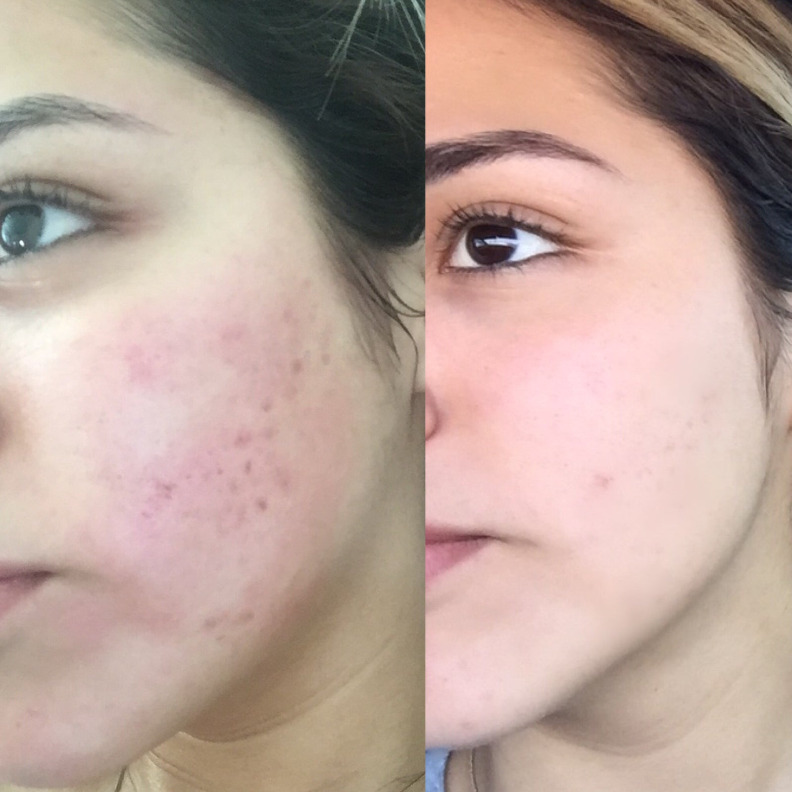 Royal Jelly Daily Moisturizer